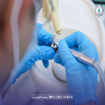 Close-up of a dentist's gloved hands using dental instruments inside a patient's open mouth during a procedure in a clinic.